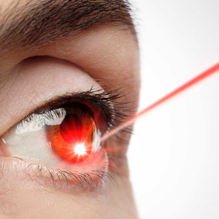 corrección de ojos con laser en chimaltenango